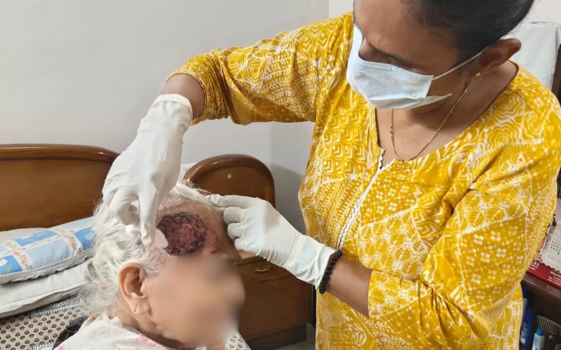 management of malignant fungating wounds in cancer patients